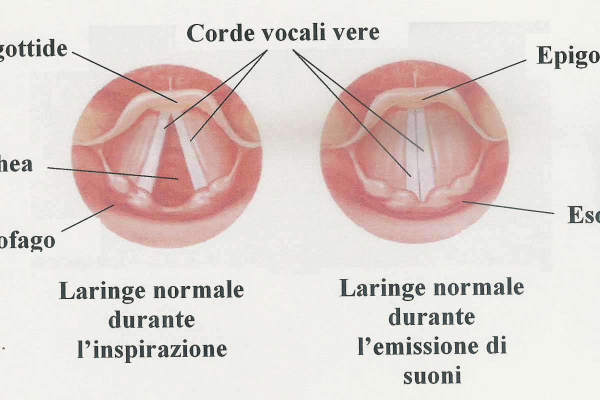 corde vocali