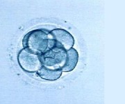 Diabete - clonazione delle cellule per aiutare a guarire