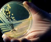 ++ BATTERIO KILLER: OMS, VARIANTE E.COLI MAI VISTA PRIMA ++