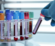 Blood tubes for centrifuging